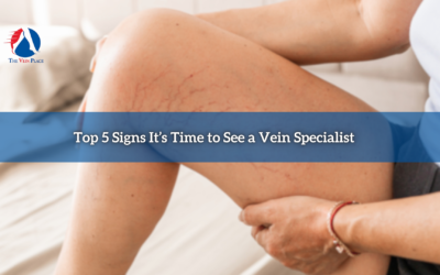 Top 5 Signs It’s Time to See a Vein Specialist