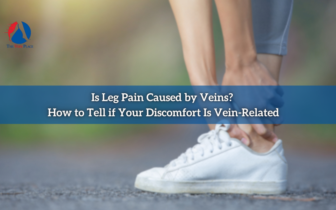 Is Leg Pain Caused by Veins? How to Tell if Your Discomfort Is Vein-Related