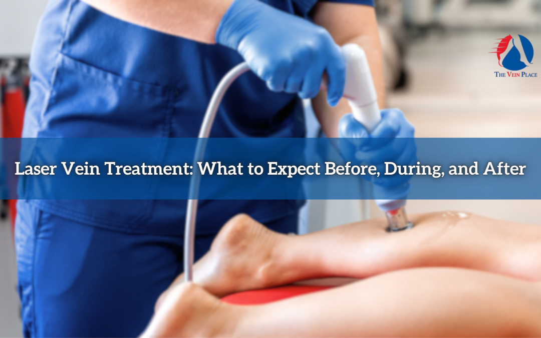 Laser Vein Treatment: What to Expect 🩺