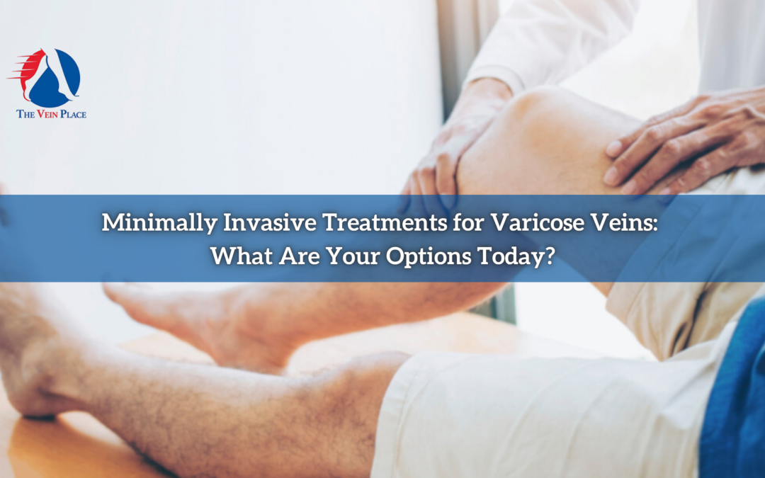 Minimally Invasive Treatments for Varicose Veins: What Are Your Options Today?