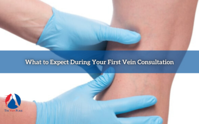 What to Expect During Your First Vein Consultation