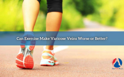 Can Exercise Make Varicose Veins Worse or Better?