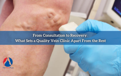 From Consultation to Recovery: What Sets a Quality Vein Clinic Apart From the Rest