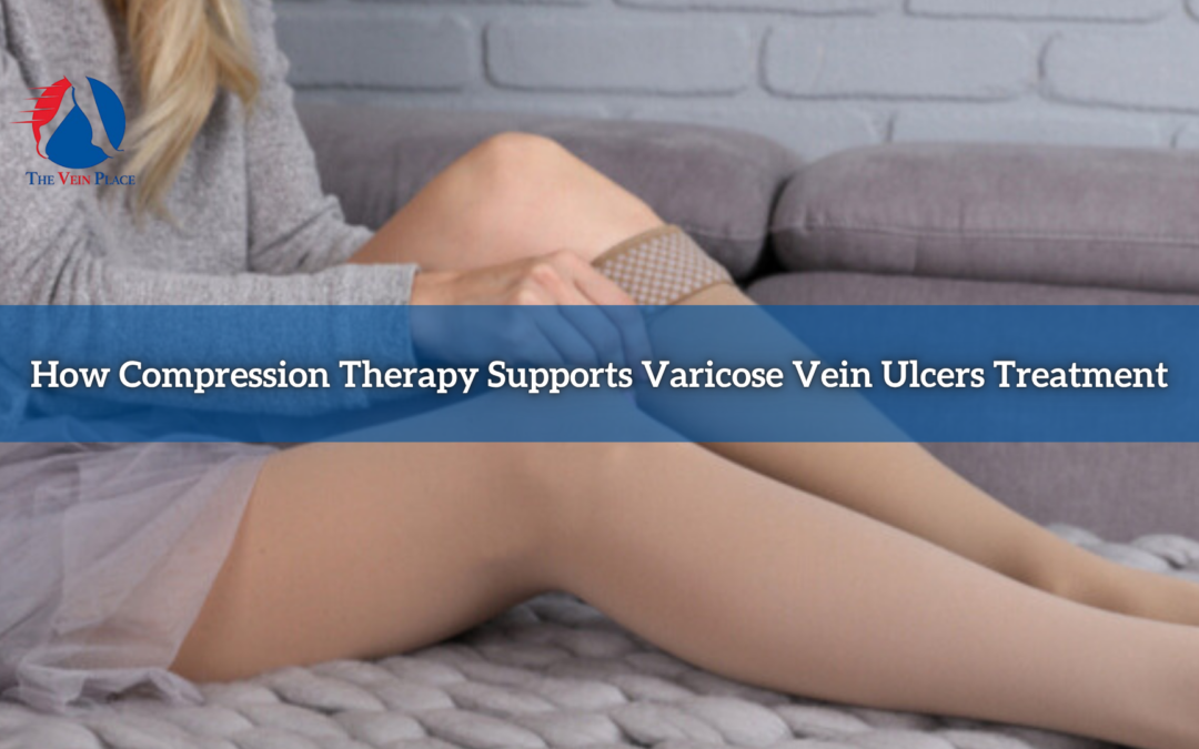 How Compression Therapy Supports Varicose Vein Ulcers Treatment