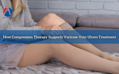 How Compression Therapy Supports Varicose Vein Ulcers Treatment