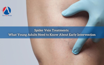 Spider Vein Treatments: What Young Adults Need to Know About Early Intervention