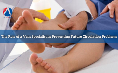 The Role of a Vein Specialist in Preventing Future Circulation Problems
