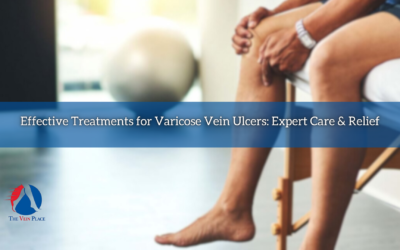Effective Treatments for Varicose Vein Ulcers: Expert Care & Relief