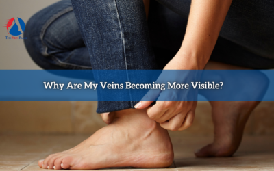 Why Are My Veins Becoming More Visible?