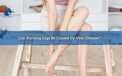 Can Burning Legs Be Caused by Vein Disease?
