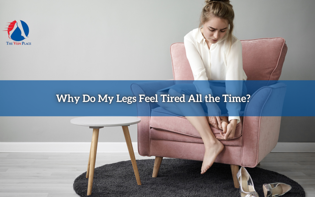 Why Do My Legs Feel Tired All the Time?