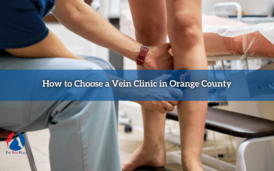 How to Choose a Vein Clinic in Orange County