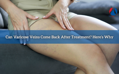 Can Varicose Veins Come Back After Treatment? Here’s Why