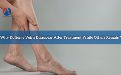 Why Do Some Veins Disappear After Treatment While Others Remain?