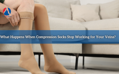 What Happens When Compression Socks Stop Working for Your Veins?